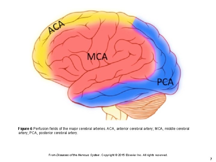 Figure 6 Perfusion fields of the major cerebral arteries. ACA, anterior cerebral artery; MCA,