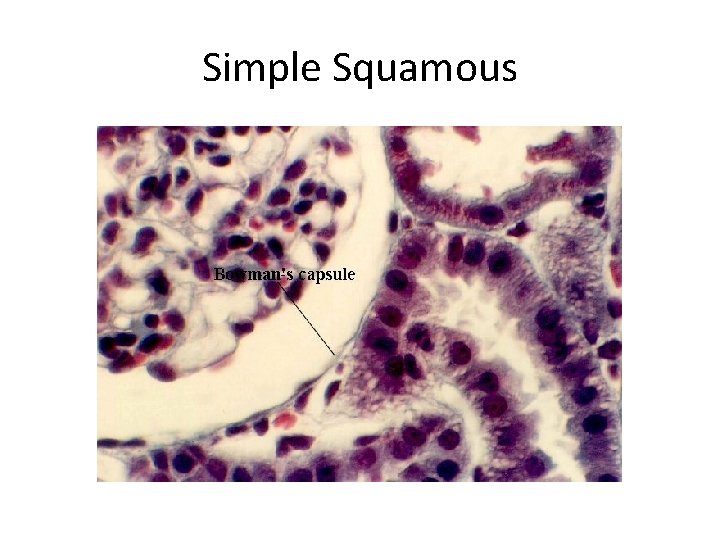 Simple Squamous 