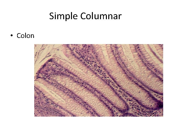 Simple Columnar • Colon 