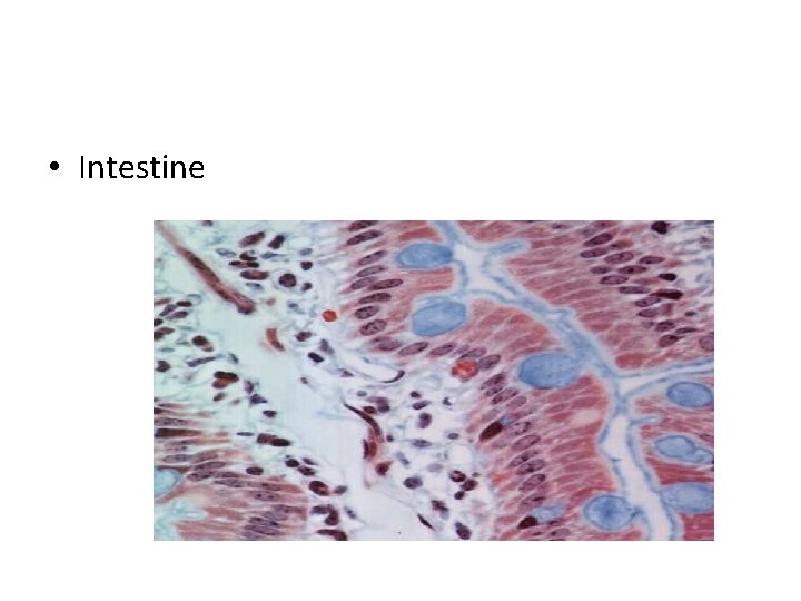  • Intestine 