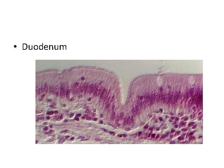  • Duodenum 