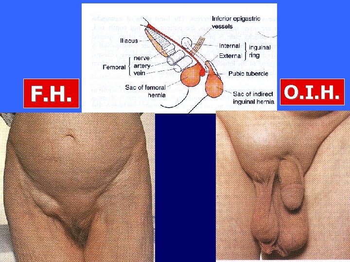 F. H. O. I. H. 