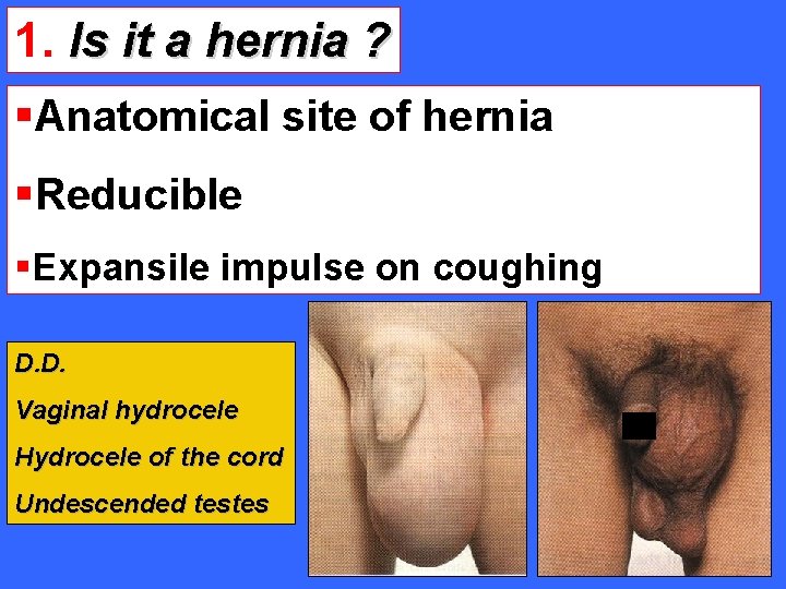 1. Is it a hernia ? §Anatomical site of hernia §Reducible §Expansile impulse on