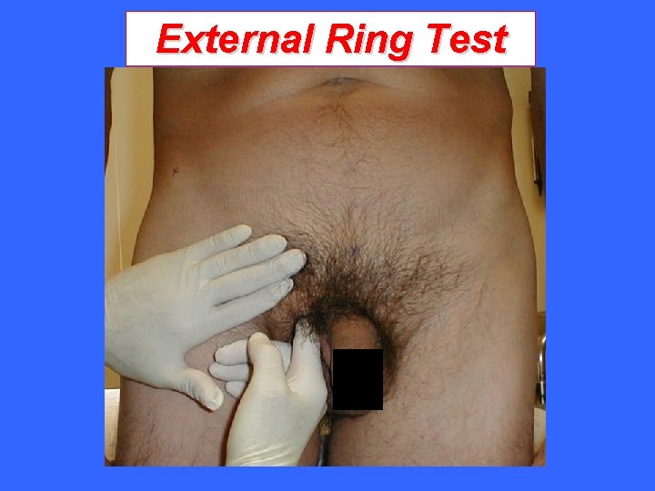 External Ring Test 
