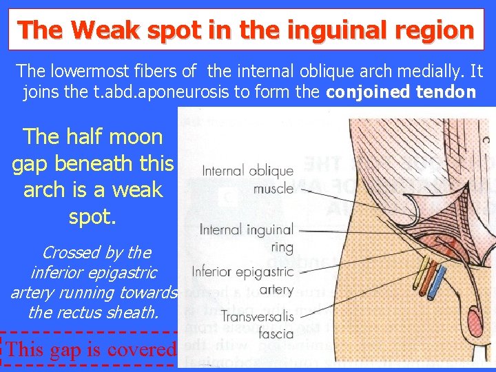 The Weak spot in the inguinal region The lowermost fibers of the internal oblique