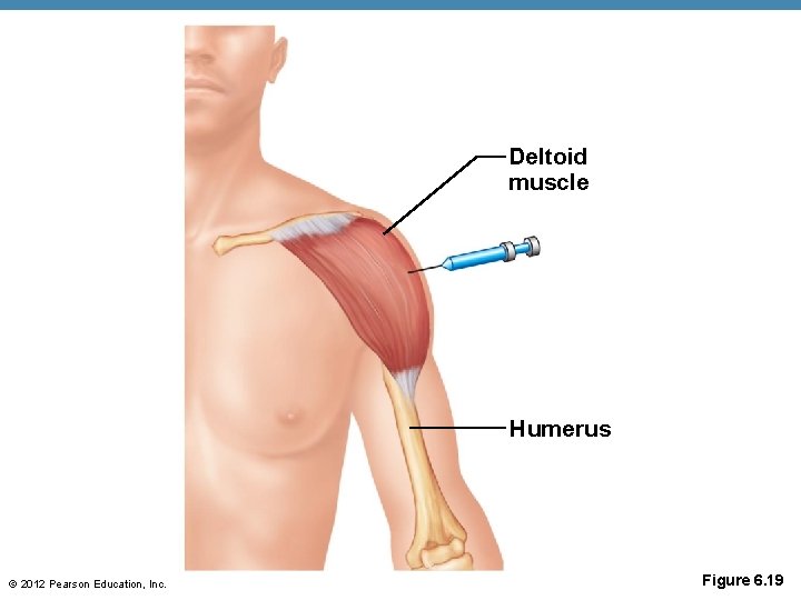 Deltoid muscle Humerus © 2012 Pearson Education, Inc. Figure 6. 19 Deltoid muscle Humerus © 2012 Pearson Education, Inc. Figure 6. 19