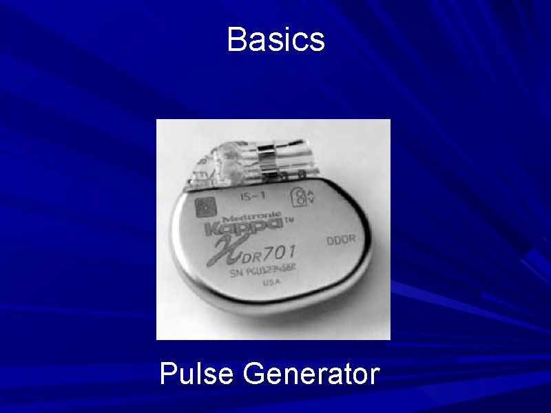 Basics Pulse Generator Basics Pulse Generator