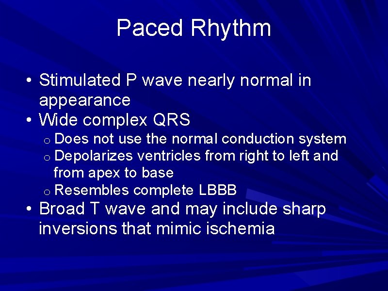 Paced Rhythm • Stimulated P wave nearly normal in appearance • Wide complex QRS