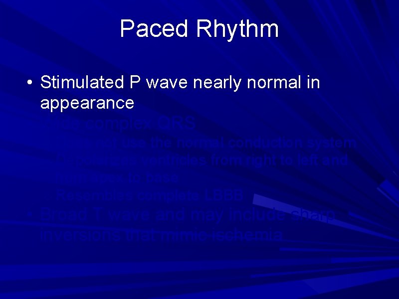 Paced Rhythm • Stimulated P wave nearly normal in appearance • Wide complex QRS Paced Rhythm • Stimulated P wave nearly normal in appearance • Wide complex QRS