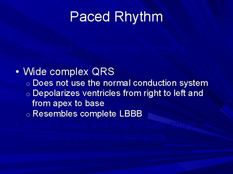 Paced Rhythm • Stimulated P wave nearly normal in appearance • Wide complex QRS Paced Rhythm • Stimulated P wave nearly normal in appearance • Wide complex QRS