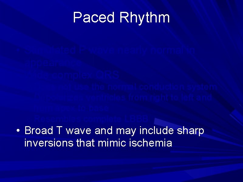 Paced Rhythm • Stimulated P wave nearly normal in appearance • Wide complex QRS Paced Rhythm • Stimulated P wave nearly normal in appearance • Wide complex QRS