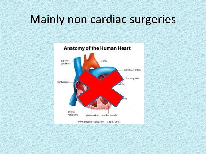 Mainly non cardiac surgeries 