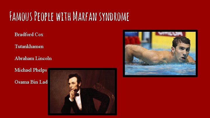Famous People with Marfan syndrome Bradford Cox Tutankhamen Abraham Lincoln Michael Phelps Osama Bin