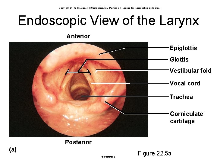 Copyright © The Mc. Graw-Hill Companies, Inc. Permission required for reproduction or display. Endoscopic