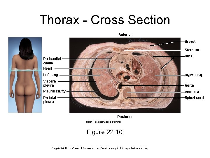 Thorax - Cross Section Anterior Breast Sternum Ribs Pericardial cavity Heart Left lung Right