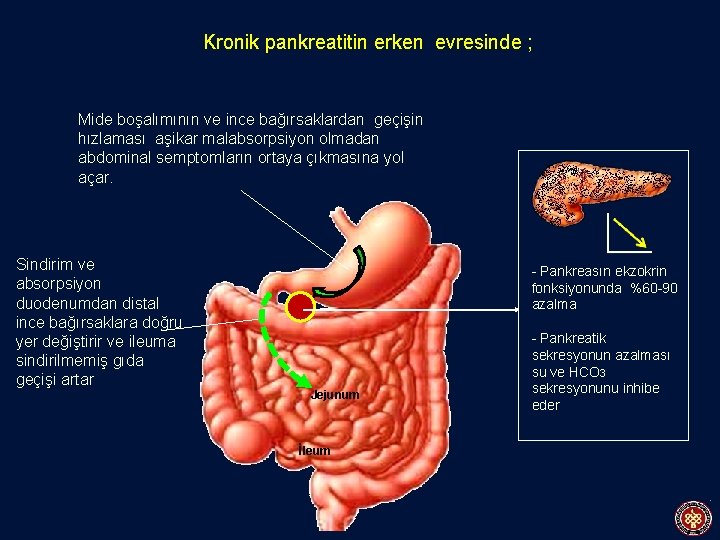 Kronik pankreatitin erken evresinde ; Mide boşalımının ve ince bağırsaklardan geçişin hızlaması aşikar malabsorpsiyon