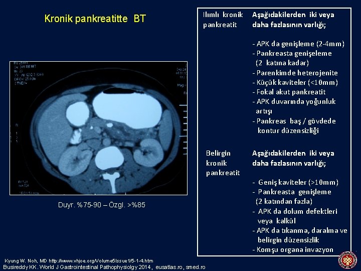 Kronik pankreatitte BT Ilımlı kronik pankreatit Aşağıdakilerden iki veya daha fazlasının varlığı; - APK