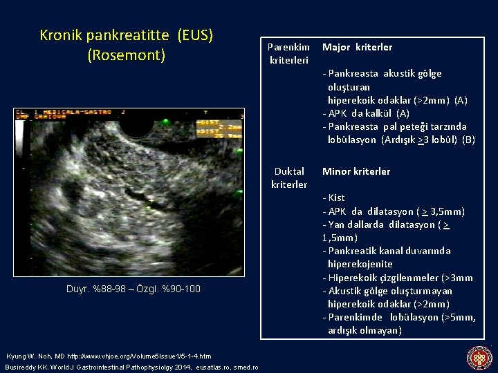 Kronik pankreatitte (EUS) (Rosemont) Duyr. %88 -98 – Özgl. %90 -100 Kyung W. Noh,