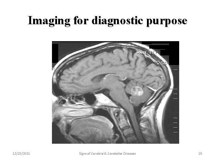 Imaging for diagnostic purpose 12/22/2021 Signs of Cerebral & Cerebellar Diseases 15 