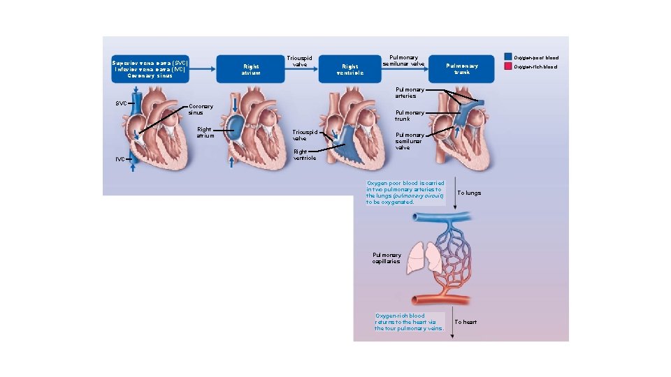Superior vena cava (SVC) Inferior vena cava (IVC) Coronary sinus Right atrium Tricuspid valve