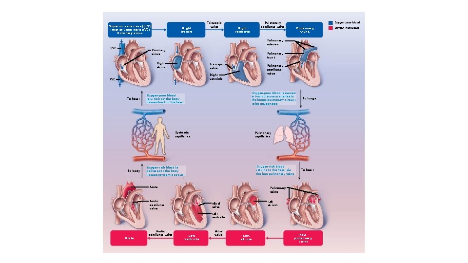 Superior vena cava (SVC) Inferior vena cava (IVC) Coronary sinus Right atrium Tricuspid valve