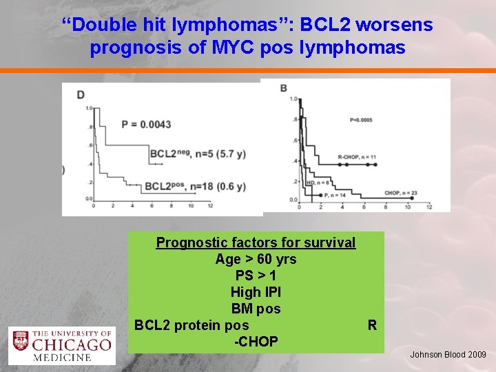 “Double hit lymphomas”: BCL 2 worsens prognosis of MYC pos lymphomas Prognostic factors for