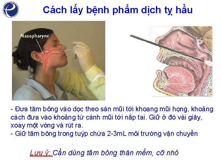 Cách lấy bệnh phẩm dịch tỵ hầu - Đưa tăm bông vào dọc theo