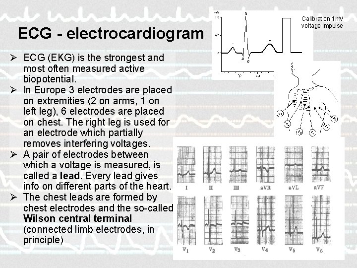 ECG - electrocardiogram Calibration 1 m. V voltage impulse Ø ECG (EKG) is the