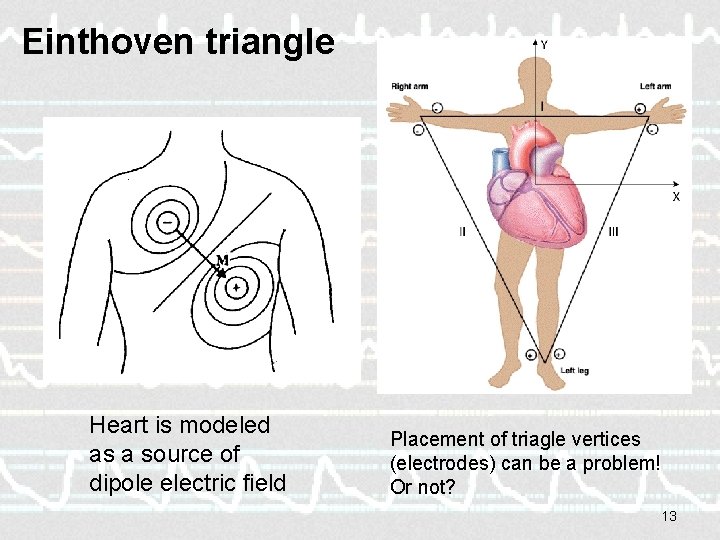 Einthoven triangle Heart is modeled as a source of dipole electric field Placement of