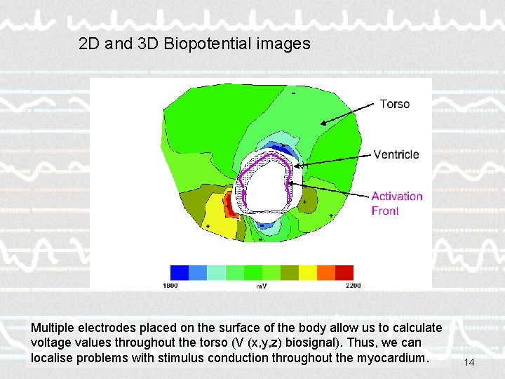 2 D and 3 D Biopotential images Multiple electrodes placed on the surface of