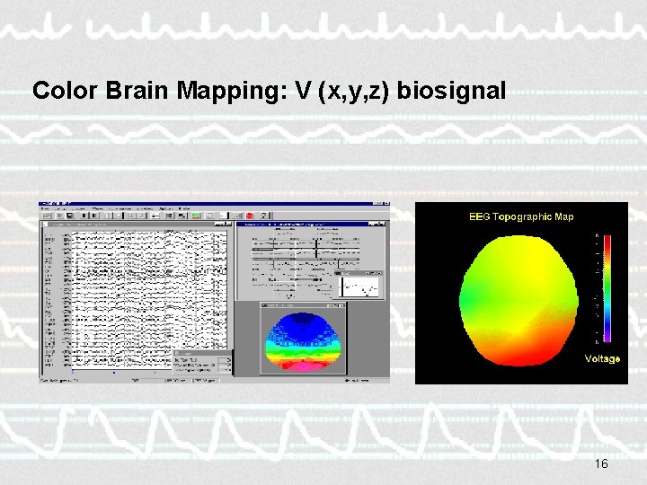 Color Brain Mapping: V (x, y, z) biosignal 16 