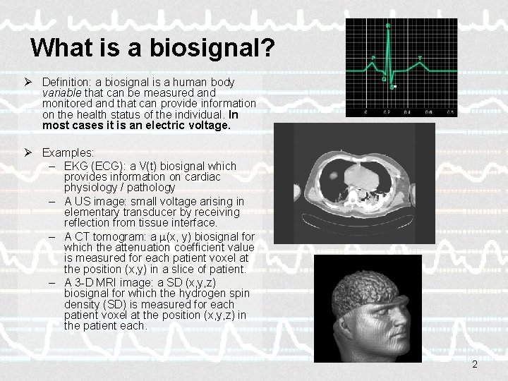 What is a biosignal? Ø Definition: a biosignal is a human body variable that