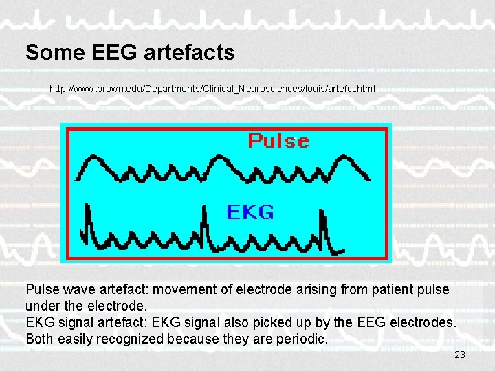 Some EEG artefacts http: //www. brown. edu/Departments/Clinical_Neurosciences/louis/artefct. html Pulse wave artefact: movement of electrode