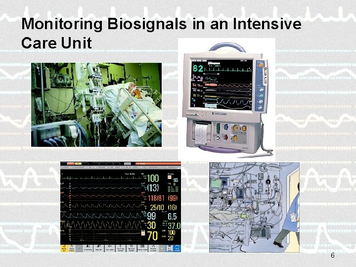 Monitoring Biosignals in an Intensive Care Unit 6 