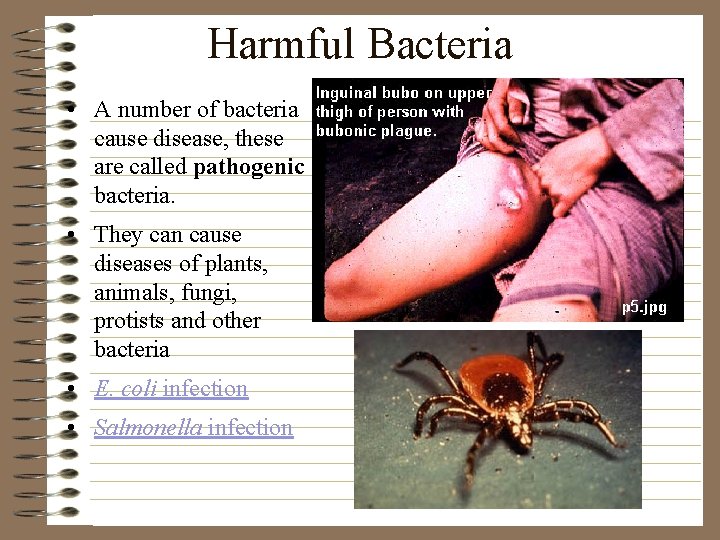 Harmful Bacteria • A number of bacteria cause disease, these are called pathogenic bacteria.