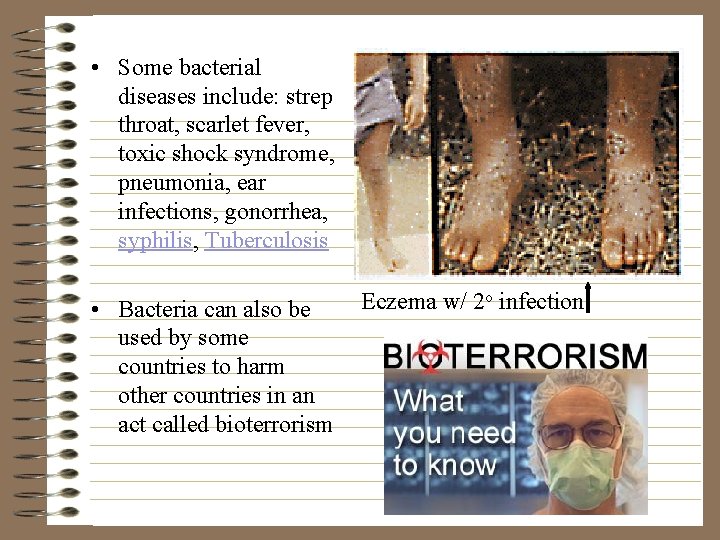 • Some bacterial diseases include: strep throat, scarlet fever, toxic shock syndrome, pneumonia,