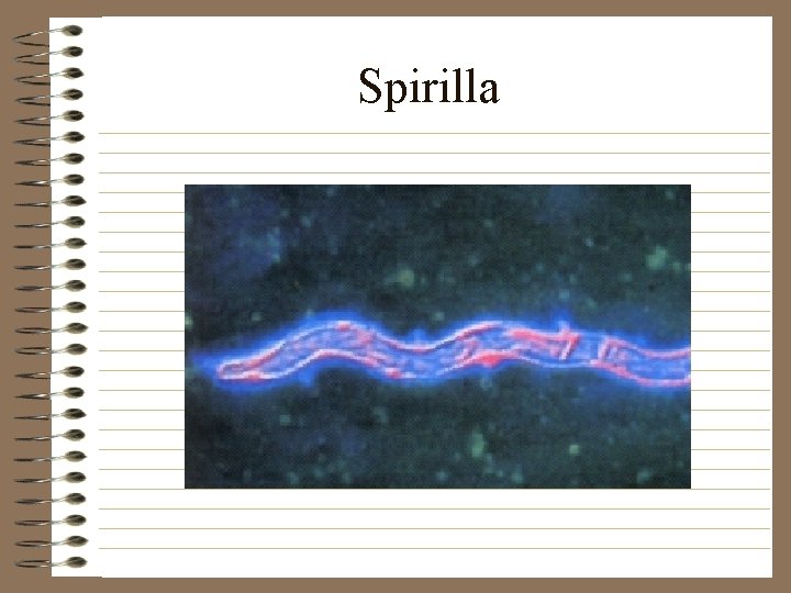 Spirilla 