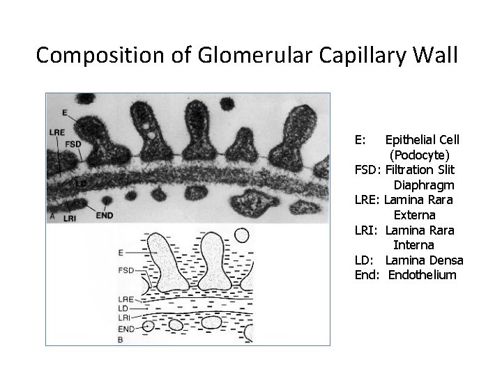 Composition of Glomerular Capillary Wall E: Epithelial Cell (Podocyte) FSD: Filtration Slit Diaphragm LRE: