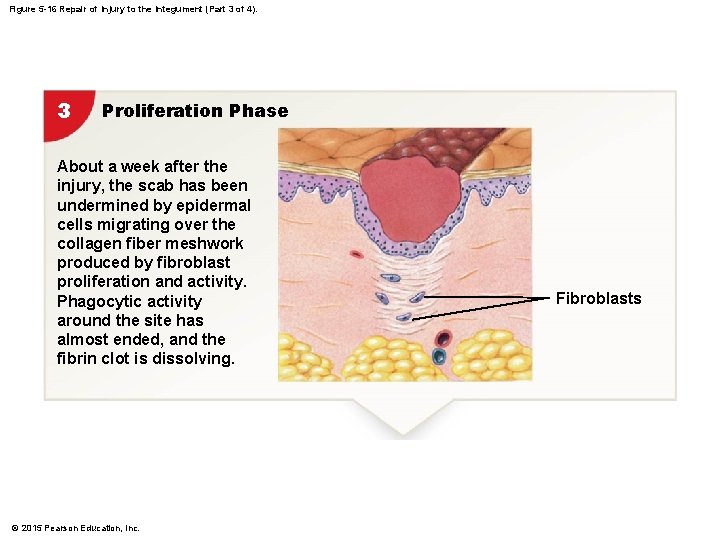 Figure 5 -16 Repair of Injury to the Integument (Part 3 of 4). 3 Figure 5 -16 Repair of Injury to the Integument (Part 3 of 4). 3