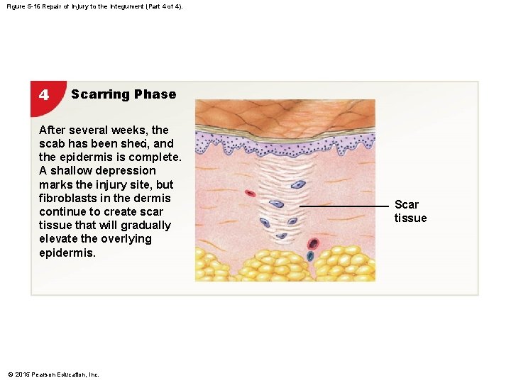 Figure 5 -16 Repair of Injury to the Integument (Part 4 of 4). 4 Figure 5 -16 Repair of Injury to the Integument (Part 4 of 4). 4