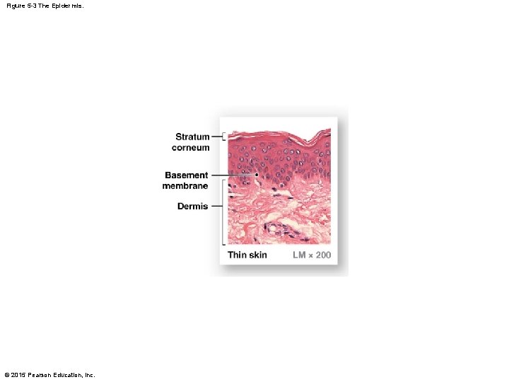 Figure 5 -3 The Epidermis. © 2015 Pearson Education, Inc. Figure 5 -3 The Epidermis. © 2015 Pearson Education, Inc.
