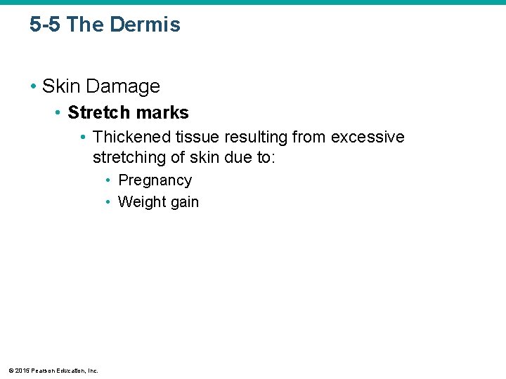5 -5 The Dermis • Skin Damage • Stretch marks • Thickened tissue resulting 5 -5 The Dermis • Skin Damage • Stretch marks • Thickened tissue resulting