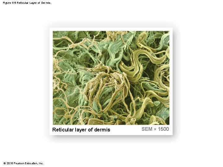 Figure 5 -8 Reticular Layer of Dermis. Reticular layer of dermis © 2015 Pearson Figure 5 -8 Reticular Layer of Dermis. Reticular layer of dermis © 2015 Pearson