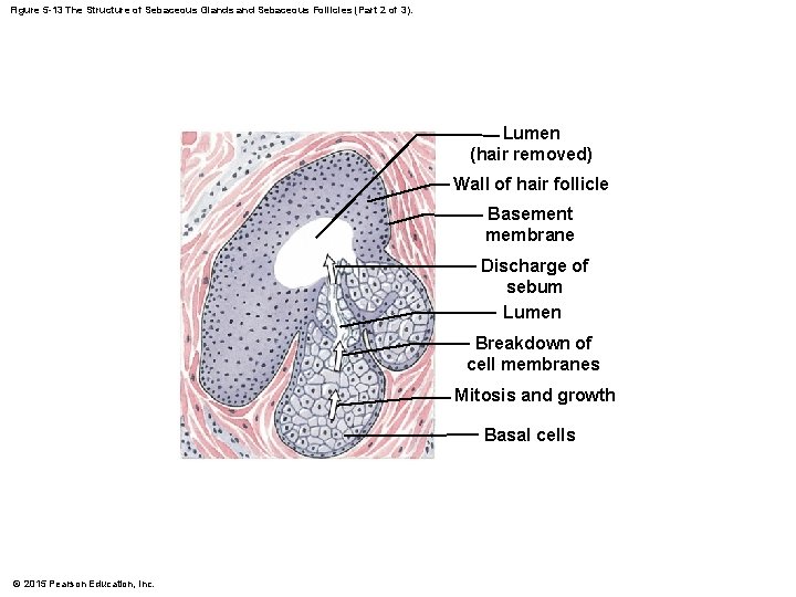 Figure 5 -13 The Structure of Sebaceous Glands and Sebaceous Follicles (Part 2 of Figure 5 -13 The Structure of Sebaceous Glands and Sebaceous Follicles (Part 2 of