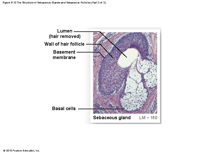 Figure 5 -13 The Structure of Sebaceous Glands and Sebaceous Follicles (Part 3 of Figure 5 -13 The Structure of Sebaceous Glands and Sebaceous Follicles (Part 3 of