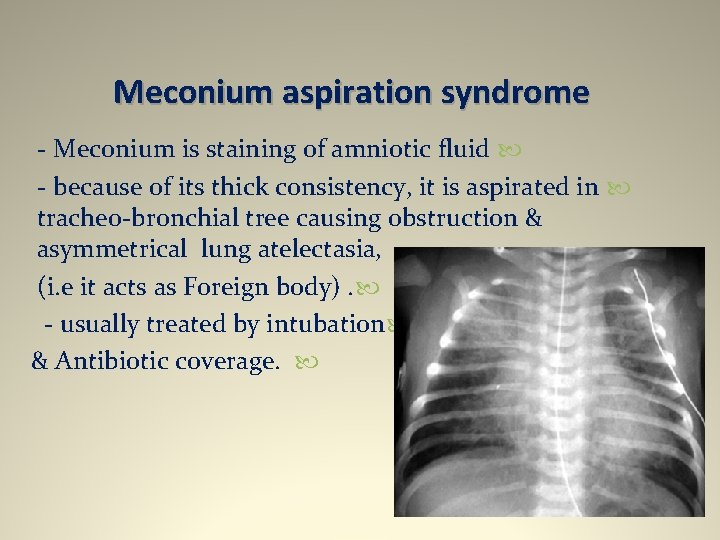 Meconium aspiration syndrome - Meconium is staining of amniotic fluid - because of its