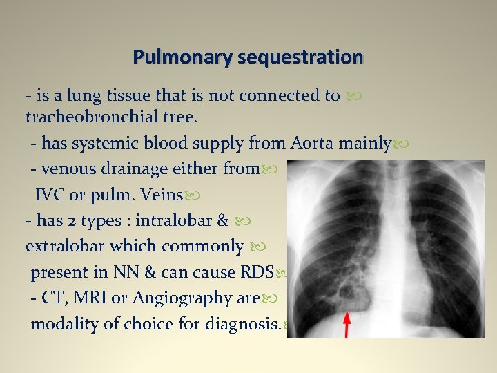 Pulmonary sequestration - is a lung tissue that is not connected to tracheobronchial tree.
