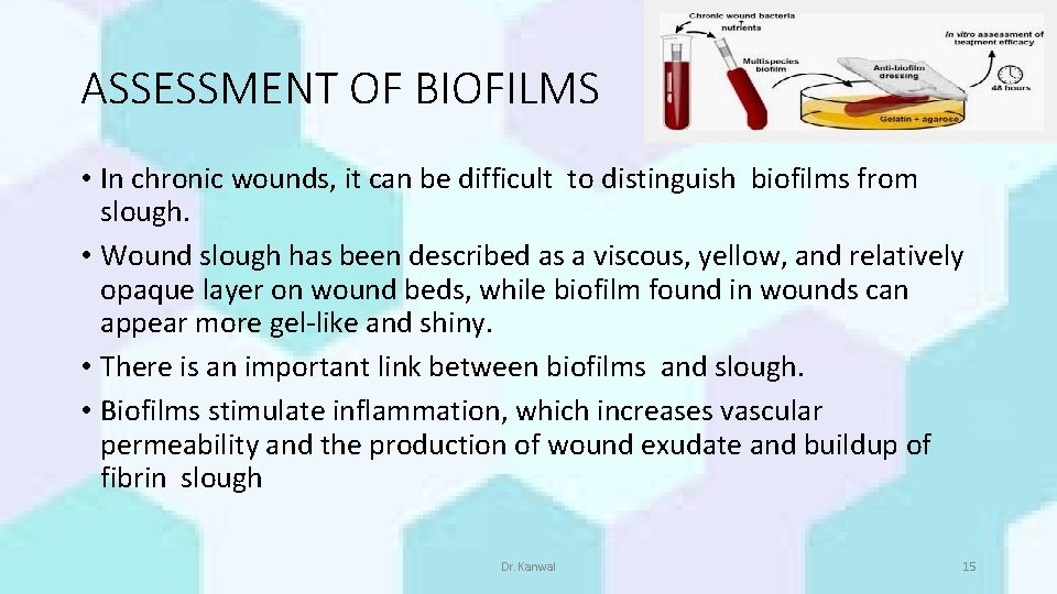 ASSESSMENT OF BIOFILMS • In chronic wounds, it can be difficult to distinguish biofilms