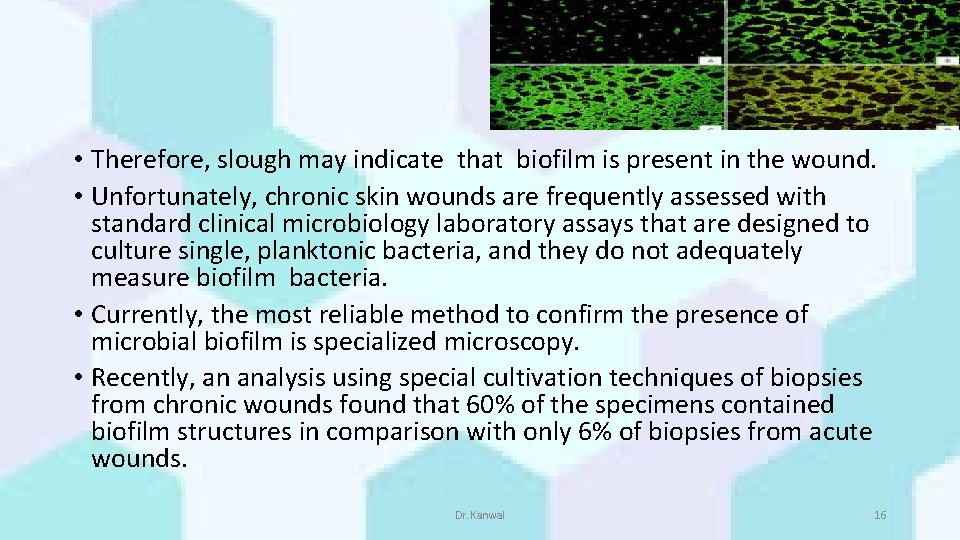  • Therefore, slough may indicate that biofilm is present in the wound. •