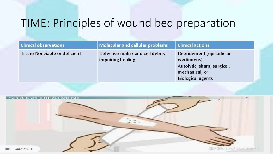 TIME: Principles of wound bed preparation Clinical observations Molecular and cellular problems Clinical actions